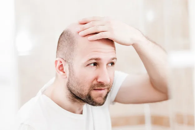 weight loss can cure hair loss