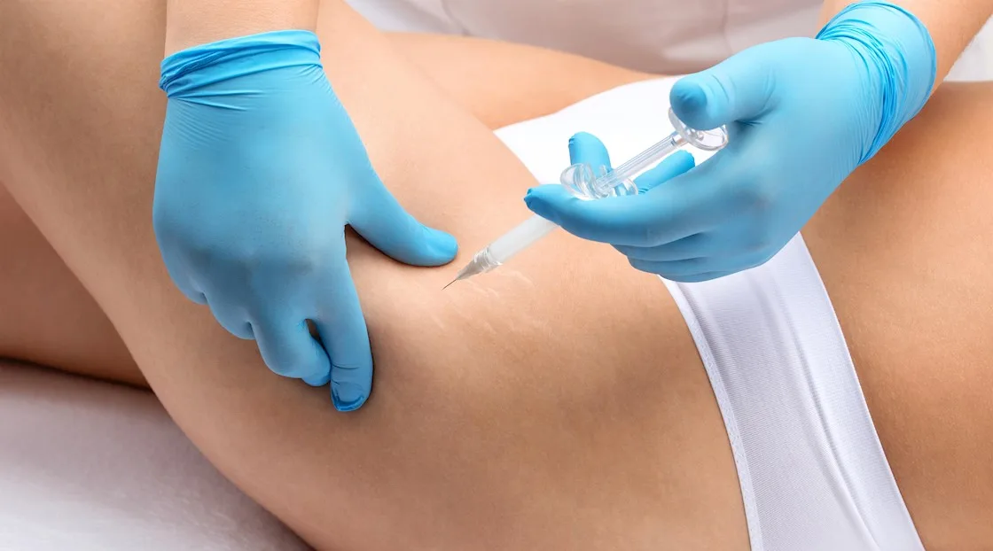 B12 Injection applying medical weight loss injections to hips-Lipotropic Injections